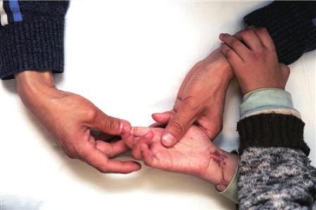 九齡童被養母砍斷手扔茅坑 進京求醫盼激活手腕