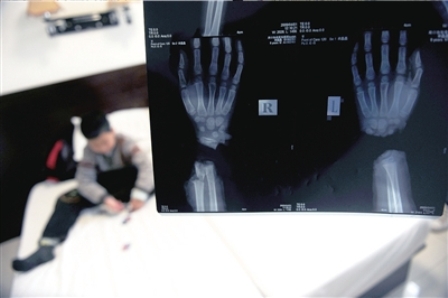 九齡童被養母砍斷手扔茅坑 進京求醫盼激活手腕