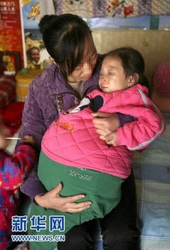 山西4歲女孩患恐怖腹水腫腹大如球 今赴京醫(yī)病