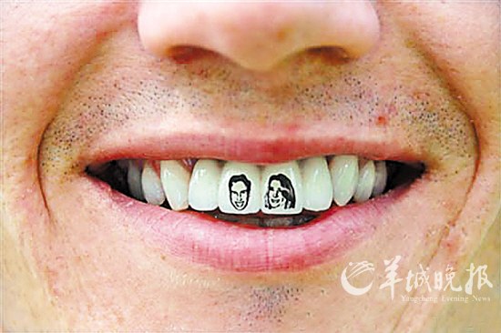 給牙齒做“文身”
