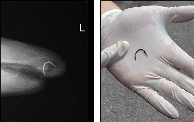 手術(shù)后遺癥？世界上第一條素食鯊魚愛吃芹菜