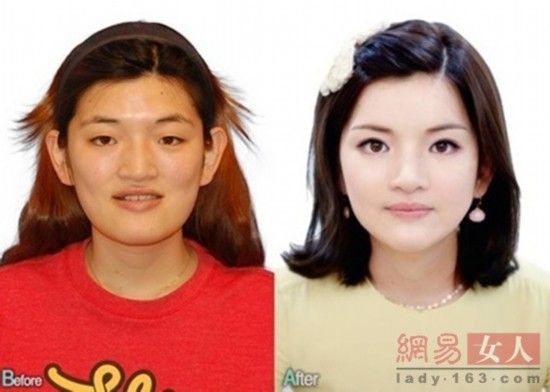 丑女變靚妹！韓國整容節(jié)目爆紅