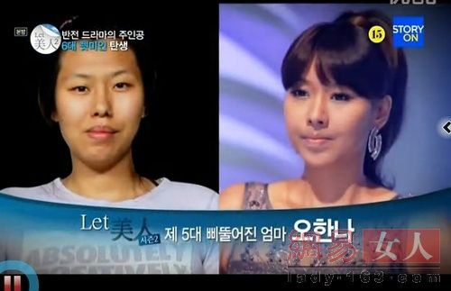 丑女變靚妹！韓國整容節目爆紅