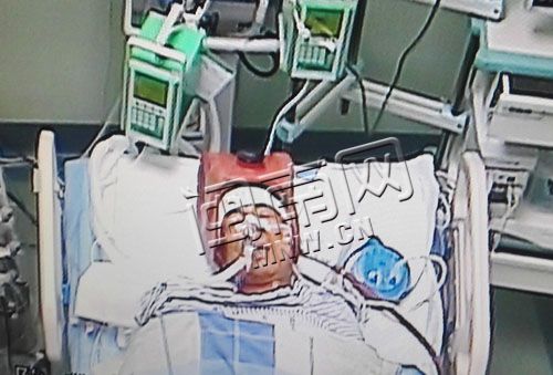 泉州60歲護林員山上撲火倒下 重癥室里昏迷不醒