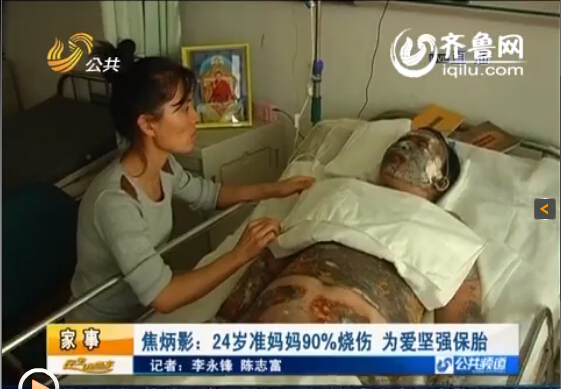 濰坊24歲準(zhǔn)媽媽全身90%燒傷 丈夫婆婆離世為愛(ài)堅(jiān)強(qiáng)保胎