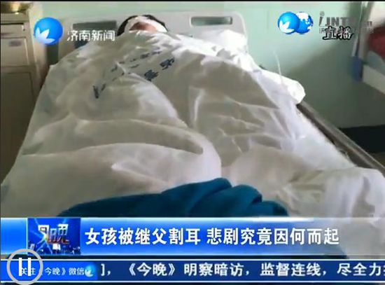 濟南一初中女生被繼父割耳朵 疑因家庭瑣事