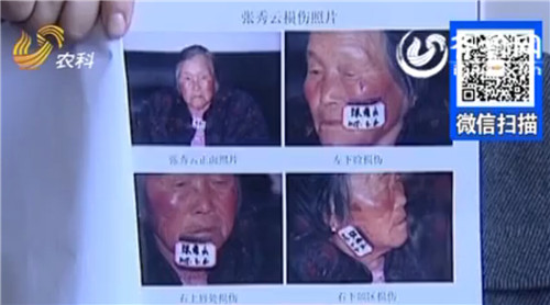 單縣老年公寓老人被管理員糞便抹臉 院方稱系試用工