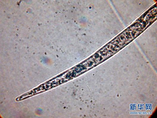 高清大圖：不只是食人魚 警惕“外來物種入侵”