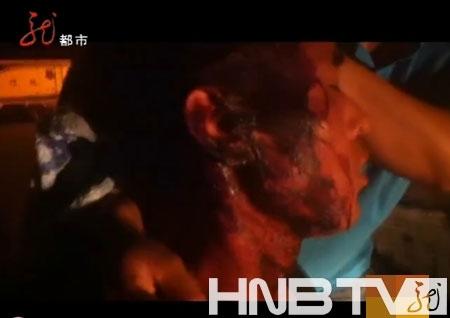 哈爾濱城管打傷瓜農(nóng) 記者求證遭搶機(jī)器險被打