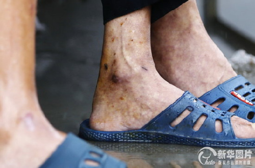 陜西一殘疾人托養院給老人戴鐵鏈 稱家屬同意(圖)