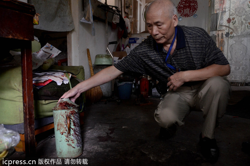 北京一老太因養狗起沖突 九旬奶奶被咬受傷