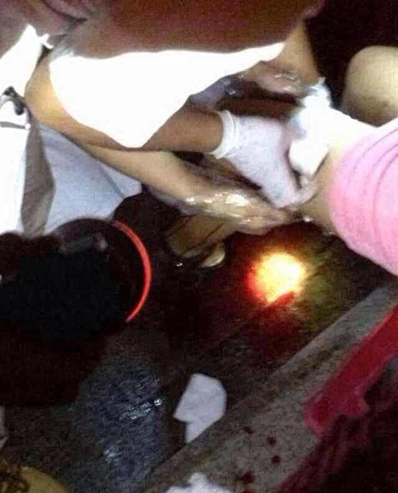 福建發(fā)生多起路人遭割肉事件 嫌疑人已被抓獲