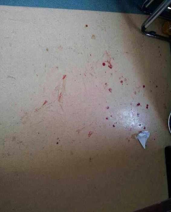 廣醫(yī)二院“抗非”英雄醫(yī)生被圍毆 因家屬欲運(yùn)尸被拒