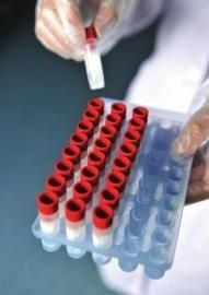 四川捐精合格率不足20% 白領合格率遠低于標準