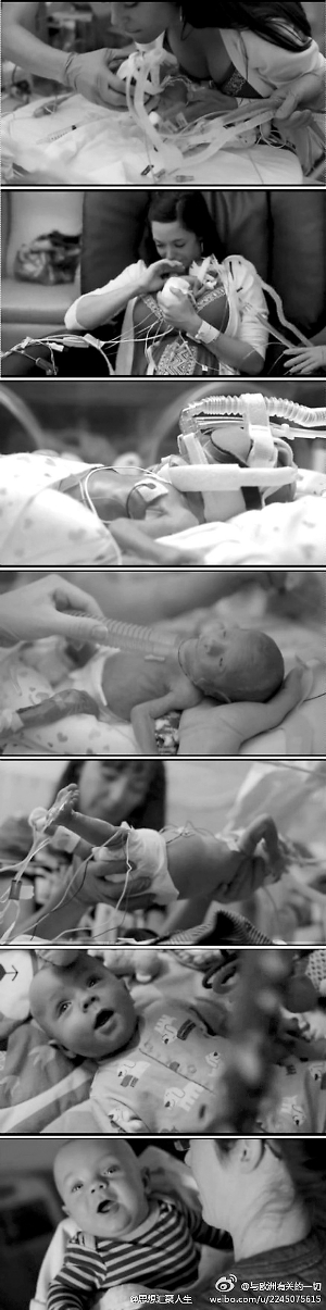 “你就是生命的奇跡！” 早產寶寶堅強活下來