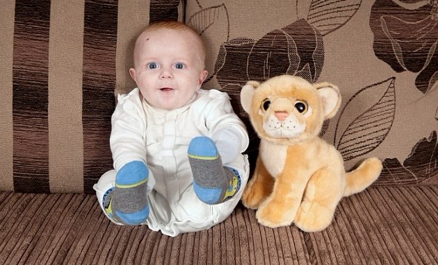 英國(guó)新生兒患罕見(jiàn)怪病 一碰皮膚就長(zhǎng)水皰無(wú)法被擁抱