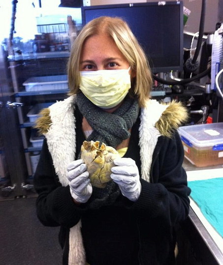 戰勝癌癥后留紀念 美國女孩手捧衰竭心臟合影