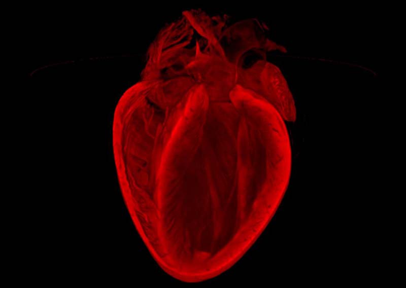 老鼠心臟醫學圖像變身絕美藝術品(高清)