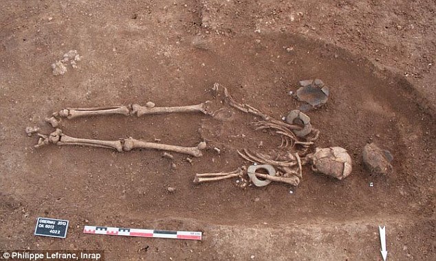 法國發(fā)現(xiàn)1650年前貴族頭骨：嚴重畸形呈錐形(組圖)