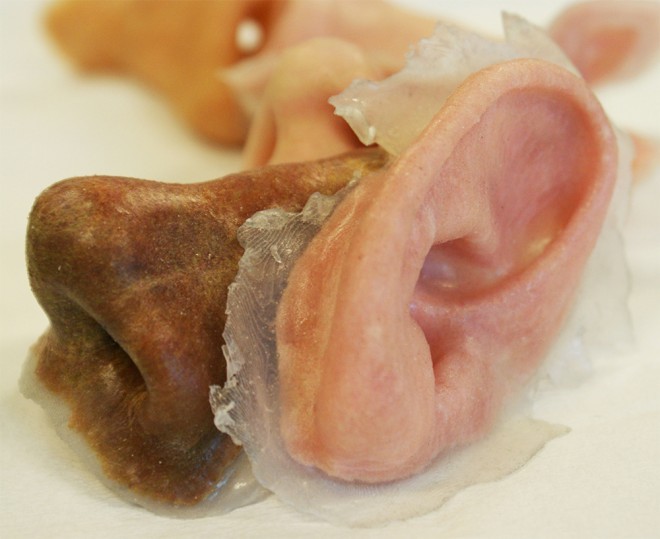 外部創傷患者福音：3-D打印鼻子、耳朵誕生