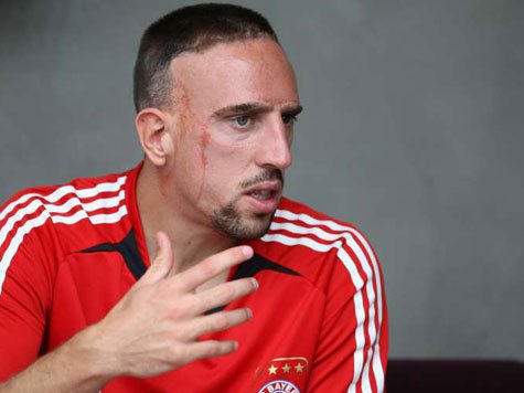 里貝里最遲10天后復(fù)出 拜仁主戰(zhàn)霍村兩翼齊飛