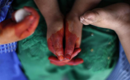 Displaced people at a repatriation centre in Pakistan